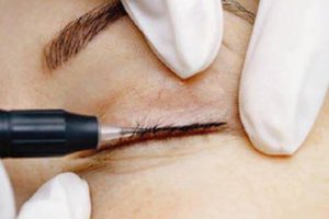 Gesichtspigmentation